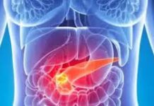 Dos fármacos despiertan esperanza para el tratamiento del cáncer de páncreas mortal