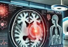 Inteligencia artificial diagnosticando tumores cerebrales en minutos en vez de en semanas