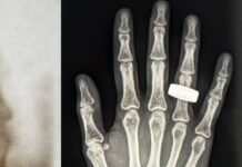 Primeras radiografías médicas hechas en el espacio