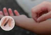 Crecen riesgos sanitarios ante presencia de GBG