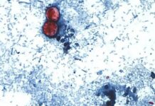 Pruebas en México han sido negativas a cyclospora, afirman