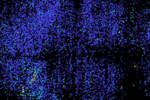 thum_4290_ver-las-neuronas-trabajando
