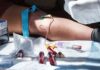 El panel asesor de la FDA respalda una controvertida prueba de sangre para detectar el cáncer